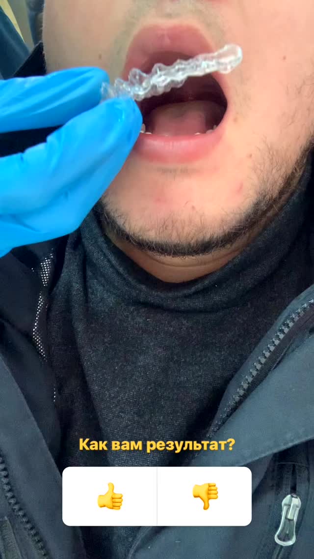 Чистка зубов